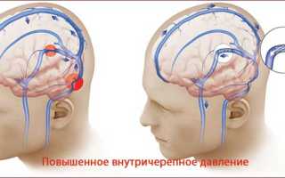 Способы лечения брадикардии народными средствами?