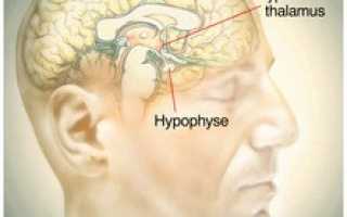 Кортизол повышен: симптомы, причины, лечение, питание